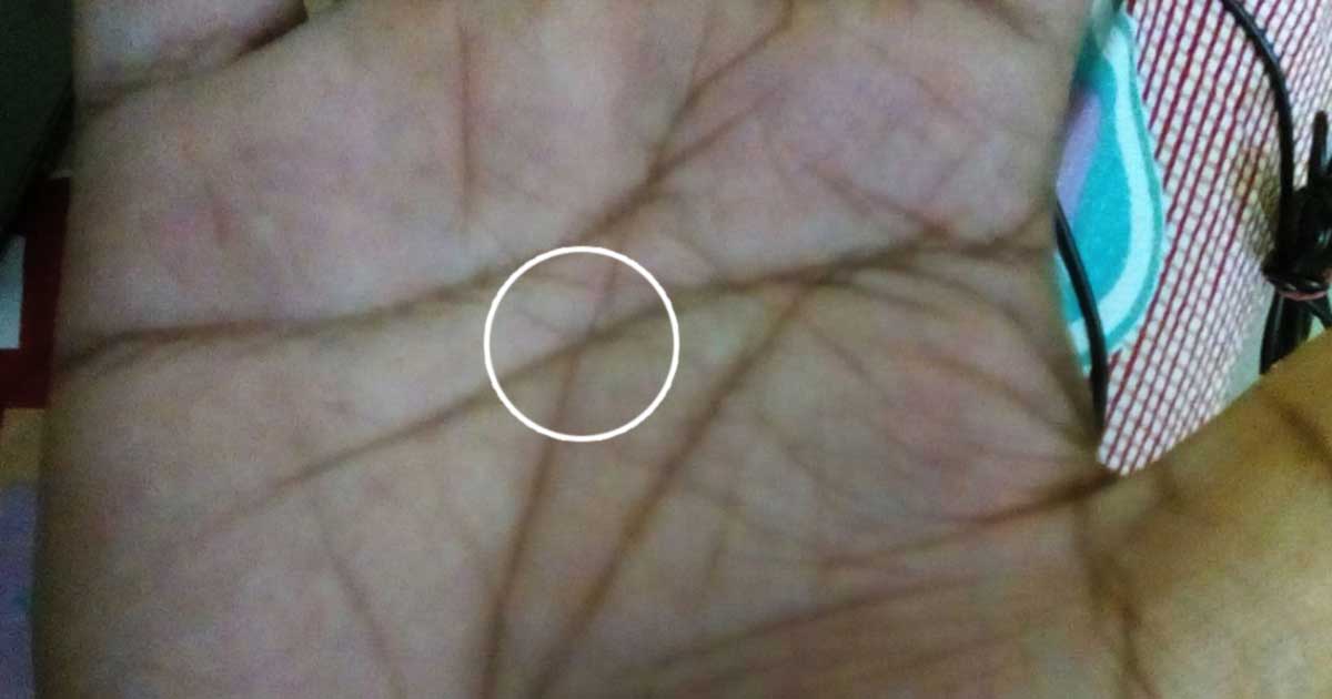 what does an x on my palm mean