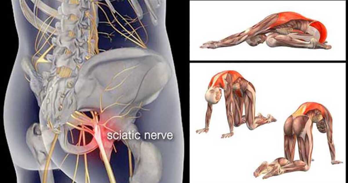 11 Piriformis Stretches to Get Rid of Sciatica, Hip, and Lower Back Pain