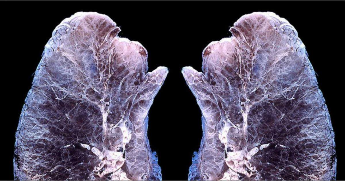 This Is What Happens With Your Lungs, and Air When You Diffuse Essential Oils