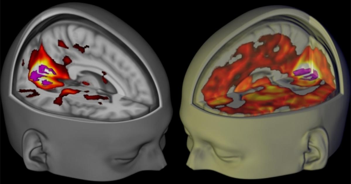 Complaining And Video Games Have A Negative Impact On Your Brain, Scientists Say