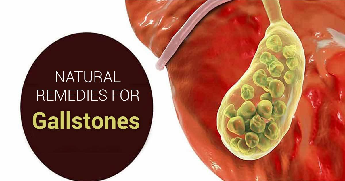 home-remedies-for-gallstones-gotta-do-the-right-thing