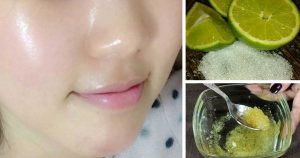 Get Smooth And Glowing Skin and Remove the Spots From Your Face With Lemon