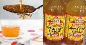 How Much Apple Cider Vinegar a Day Can Help You Lose Weight