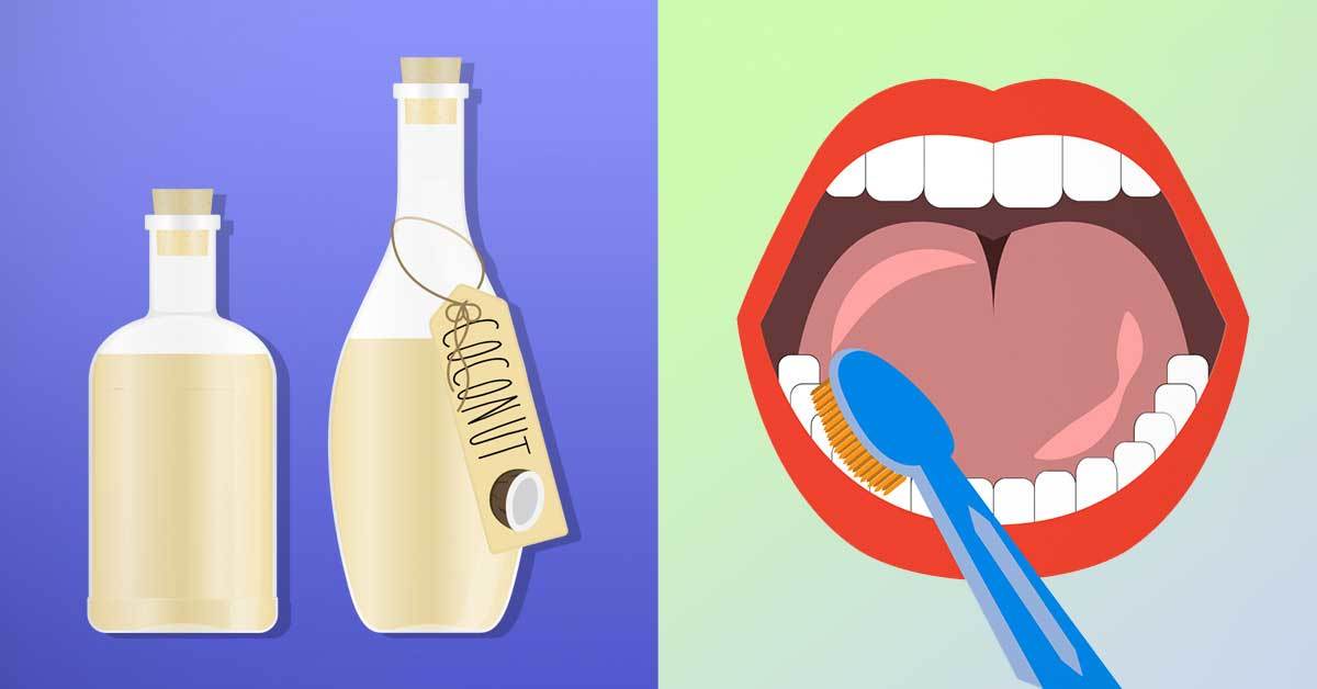 Treat Cavities and Decomposed Teeth with Coconut Oil! 1