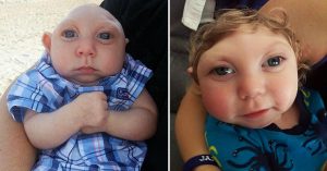 Jaxon Buell Was Born Almost Without a Brain and Not Expected to Live Long 1
