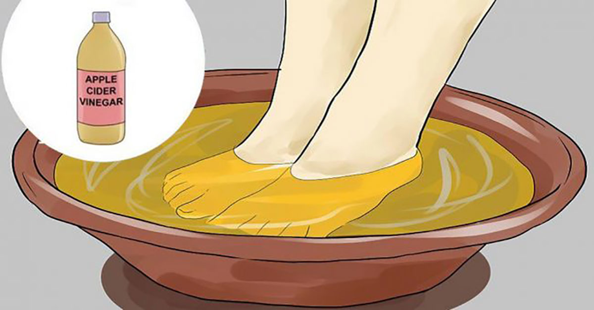 Soaking Feet In Vinegar Mixture Can Be Very Beneficial